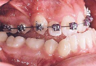 7 mostra os resultados de uma consulta desgirando um dente.
