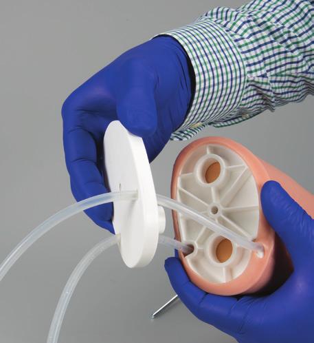 Coloque as extremidades dos tubos em um recipiente ou balde a fim de remover o restante do sangue do sistema de tubos Caso não esteja utilizando o braço para
