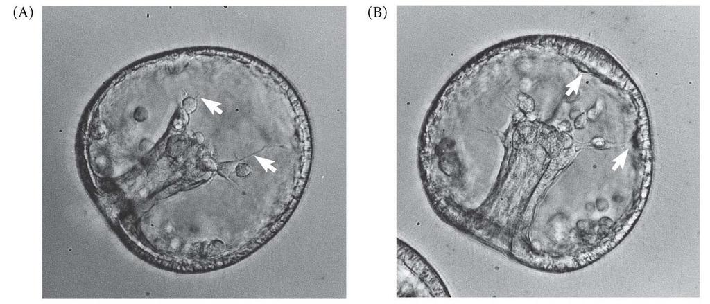 Filopódios das células mesenquimais secundárias A blástula de anfíbio contém uma blastocele interna