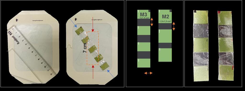 121 sugere-se que a tira não ultrapasse os 7 cm para que exista uma margem que facilite o posicionamento da tira no Tegaderm durante a cirurgia, como assinalado na figura 7.5(a).