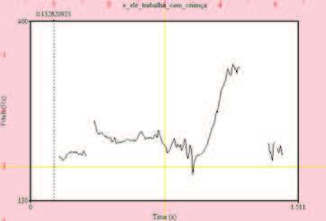 Figura 2 curva de F0 da sentença e ele trabalha com criança?