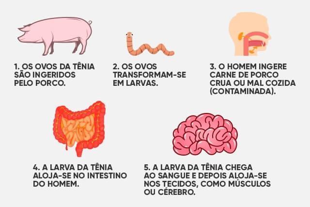 Principais doenças transmitidas pelo solo contaminado Ancilostomíase: infecções causadas por parasitos intestinais da família dos ancilostomídeos.