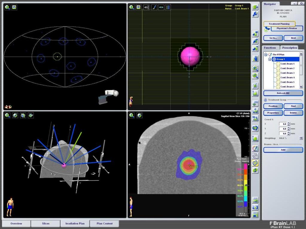 Materiais e Métodos Tabela 4: Angulações do gantry e da mesa para o planejamento com 9 campos estáticos para o caso de melanoma.