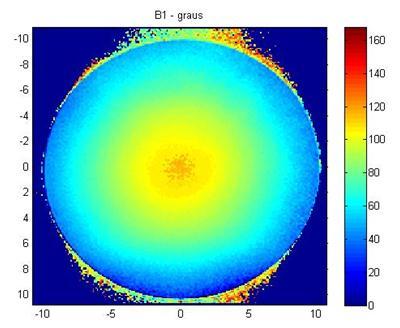 (b1) (b2) (c1) Figura 300: MRI dos cortes axiais das regiões do cilindro de PMMA: (a1)