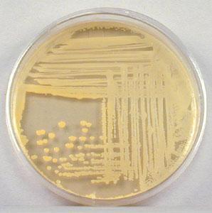 15 Figura 1: Colônias típicas de Staphylococcus aureus. Fonte: American Society for Microbiology,disponível em http://jb.asm.org/content/vol186/issue9/cover.dtl 1.1.2 Patogênese S.