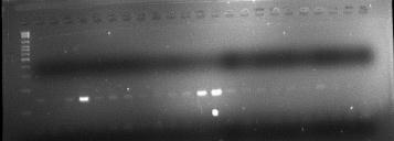 29 1.5.2.1 PCR para detecção do gene meca Nos últimos anos o método da CIM foi substituído por métodos moleculares que detectam o gene meca.