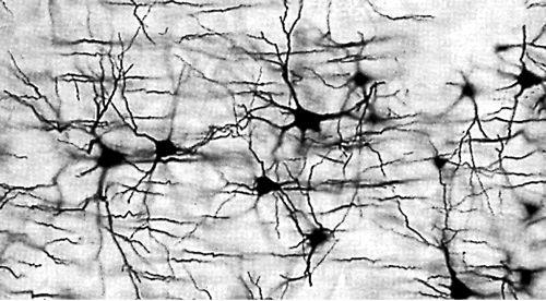 Redes Neuronais Cérebro humano. Mais fascinante processador existente. Aprox.