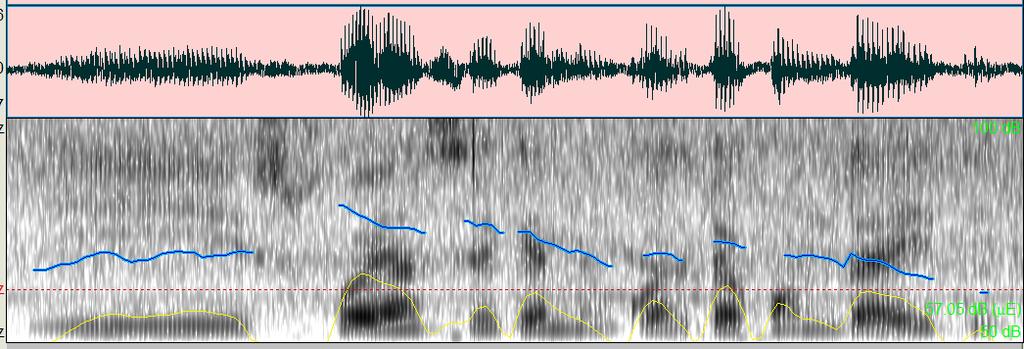Mais especificamente, um áudio avaliado como de qualidade muito alta ou alta possui quase sempre uma qualidade apropriada para quase todo tipo de análise fonética, poucas sobreposições de voz, quase