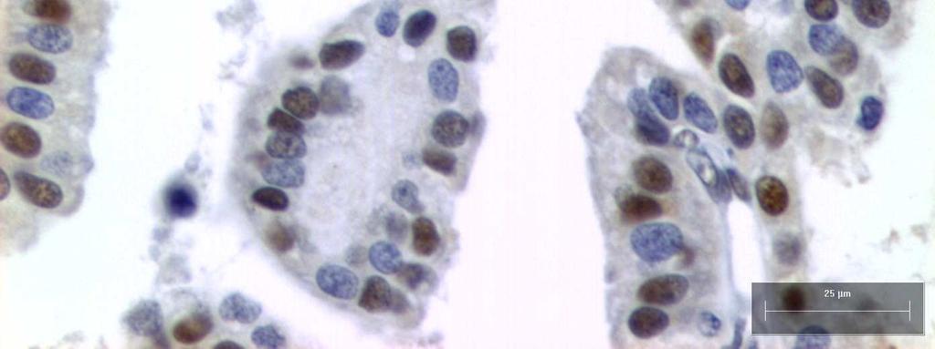 Núcleos das células     µm