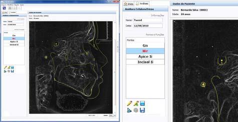ponto, mover pontos, recursos de edição das estruturas cefalométricas (contornos anatômicos), geração de traçado entre outros.