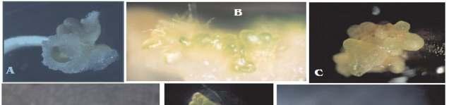 Fig. 1A-K: Somatic embryogenesis and plant regeneration in Eucalyptus globulus.