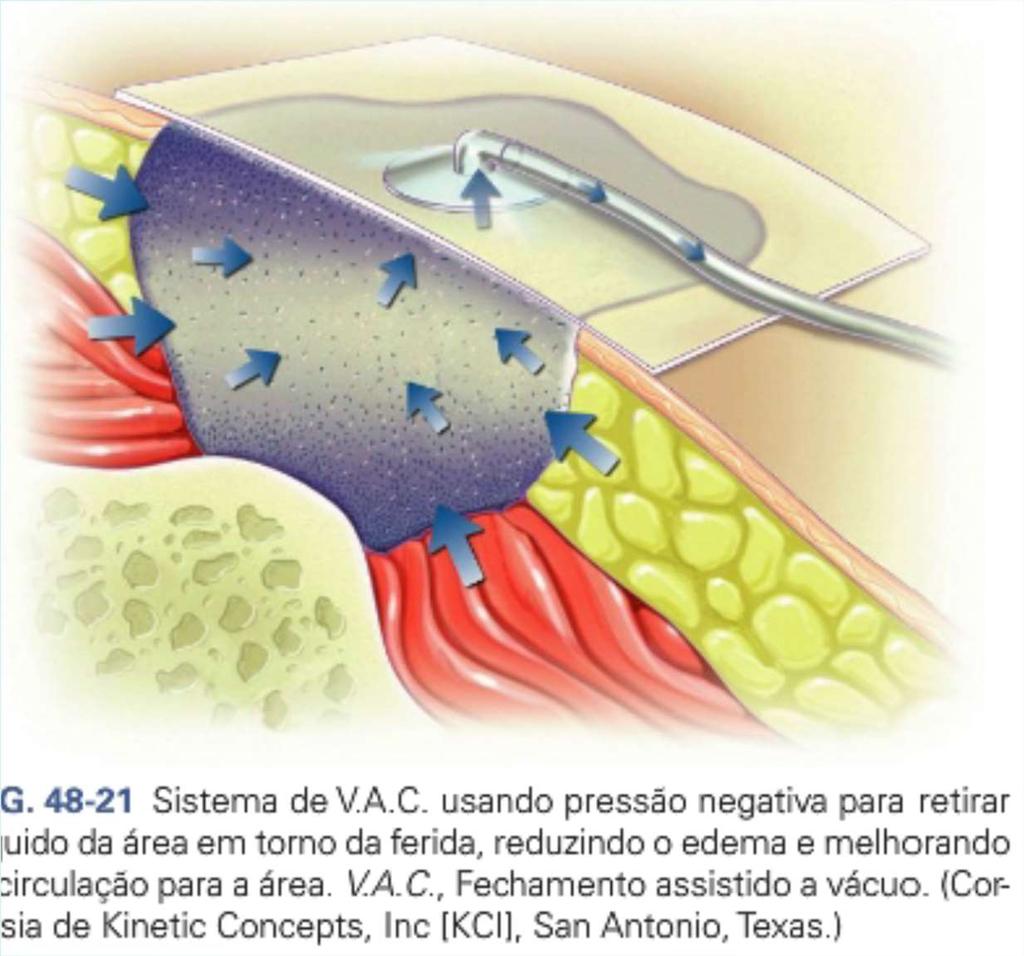 Bomba de Vácuo