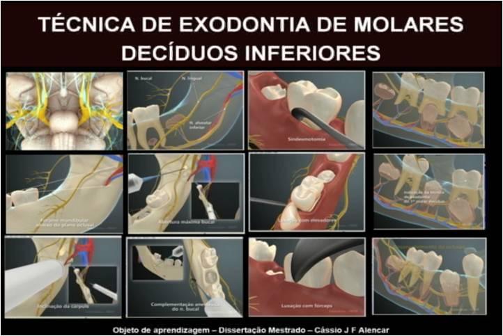 A Odontologia na Política de Formação dos Profissionais de Saúde, o papel da Teleodontologia como