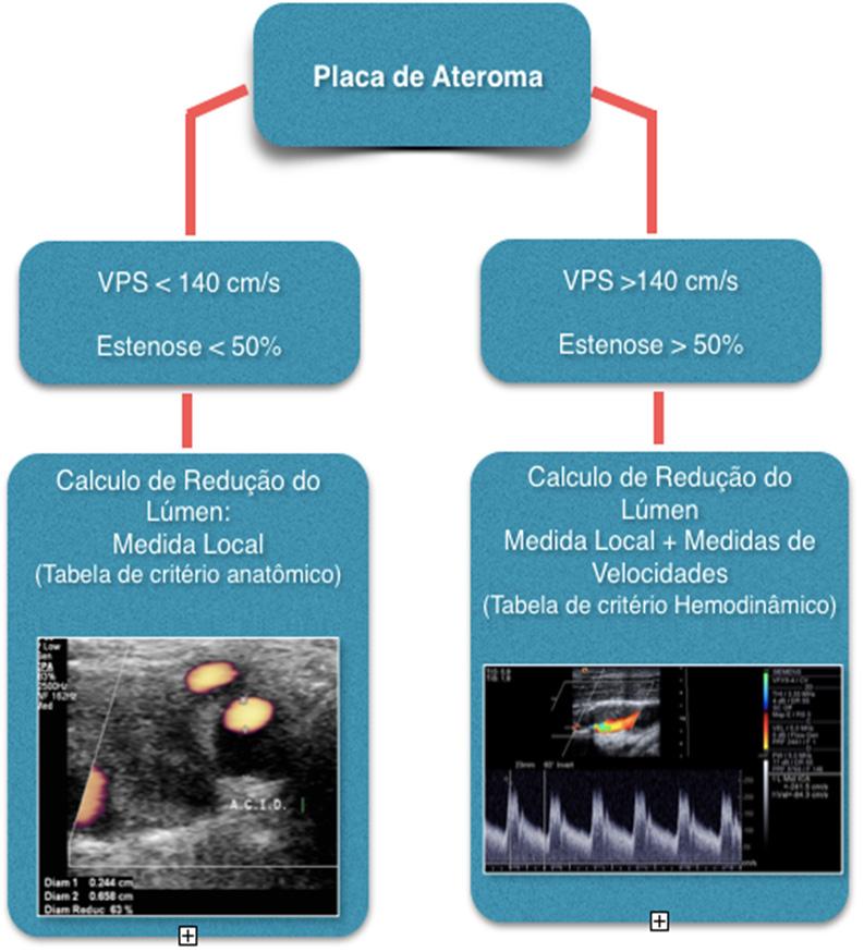 Figura 3 Recomendação do Departamento de Imagem Cardiovascular da Sociedade