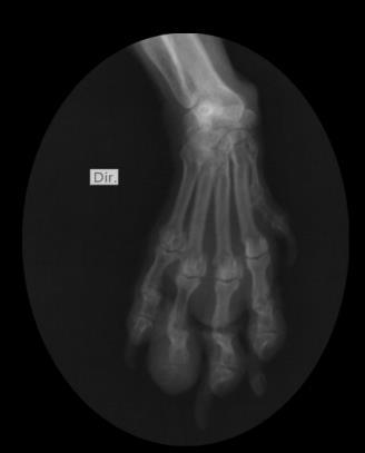 9 Figura 2 Imagem radiográfica evidenciando um importante aumento de volume de tecidos moles em correspondência ao 4º coxim digital direito e discreto fragmento de falange distal do 4º dedo direito.