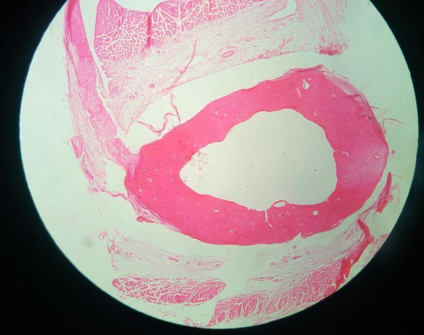 13 Figura 6 Foto do exame histopatológico ilustrando o corte com margens de segurança, onde não tem indícios de neoplasia na falange proximal Objetiva 10x Fonte: Arquivo Pessoal.