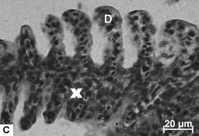 Verificar a proliferação de células entre as lamelas (X), desprendimento do epitélio de epitélio (seta), dilatação de capilares e espessamento de lamelas