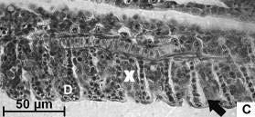 Observar a proliferação de células entre lamelas (X), desprendimento de células do epitélio (seta) e dilatação de capilares