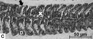 Notar a proliferação de células entre lamelas (X), inclusive a fusão completa de todas