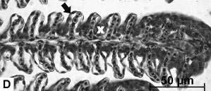 capilares e espessamento de lamelas secundárias (D) além da presença de aneurisma