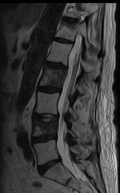 Coluna vertebral Para lembrar RM