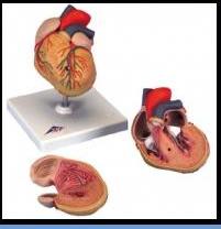 COMPLICAÇÕES DA HIPERTENSÃO ARTERIAL CARDÍACAS Hipertrofia ventricular esquerda (HVE) Sobrecarga cardíaca èprogressão da HVE è degeneração da função