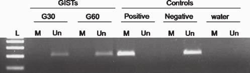 280 Virchows Arch (2009) 455:277 284 Fig. 2 Agarose gel (2%) showing MSP result for methylation analysis of RKIP gene in the two cases with RKIP loss of expression (G30 and G60).