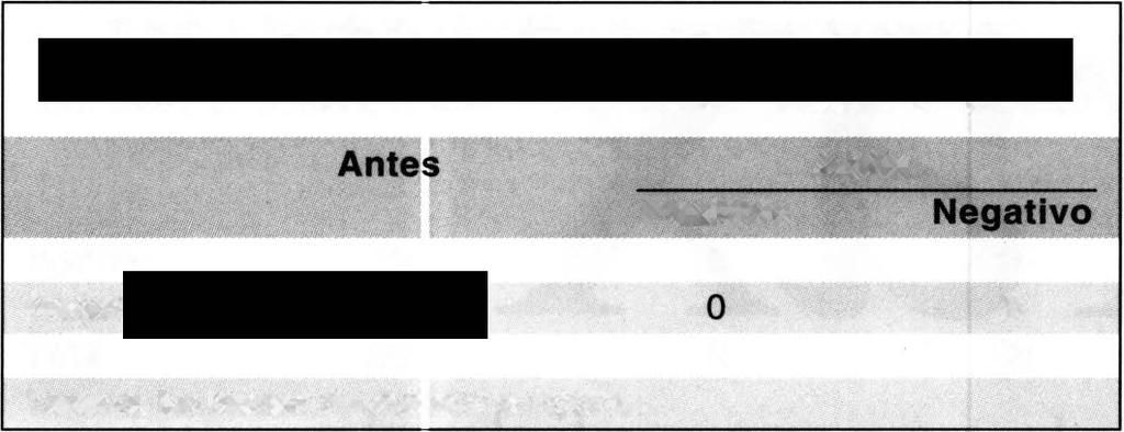 Biom icroscopia ultrasônica do segmento anterior de olhos com seio camerular passível de oclusão Tabela 1.