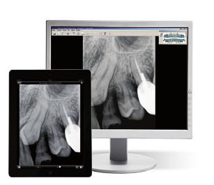 A aplicação portátil RVG proporciona acesso aos seus ficheiros de software de imagiologia dentária, permitindo-lhe transferir facilmente as imagens armazenadas entre o computador e o dispositivo