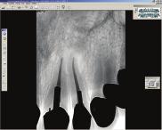 Por ser a única ferramenta de imagiologia dentária na indústria a proporcionar essa compatibilidade, a aplicação portátil RVG transforma qualquer ipad, ipod touch ou iphone numa ferramenta funcional