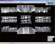 No entanto, as imagens visualizadas num ipod/iphone não são adequadas para fins de diagnóstico. Contacte um representante sobre a compatibilidade do ipad, iphone e ipod touch.