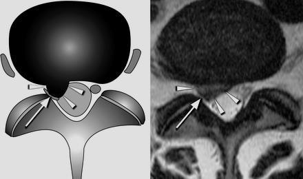 DISCAL