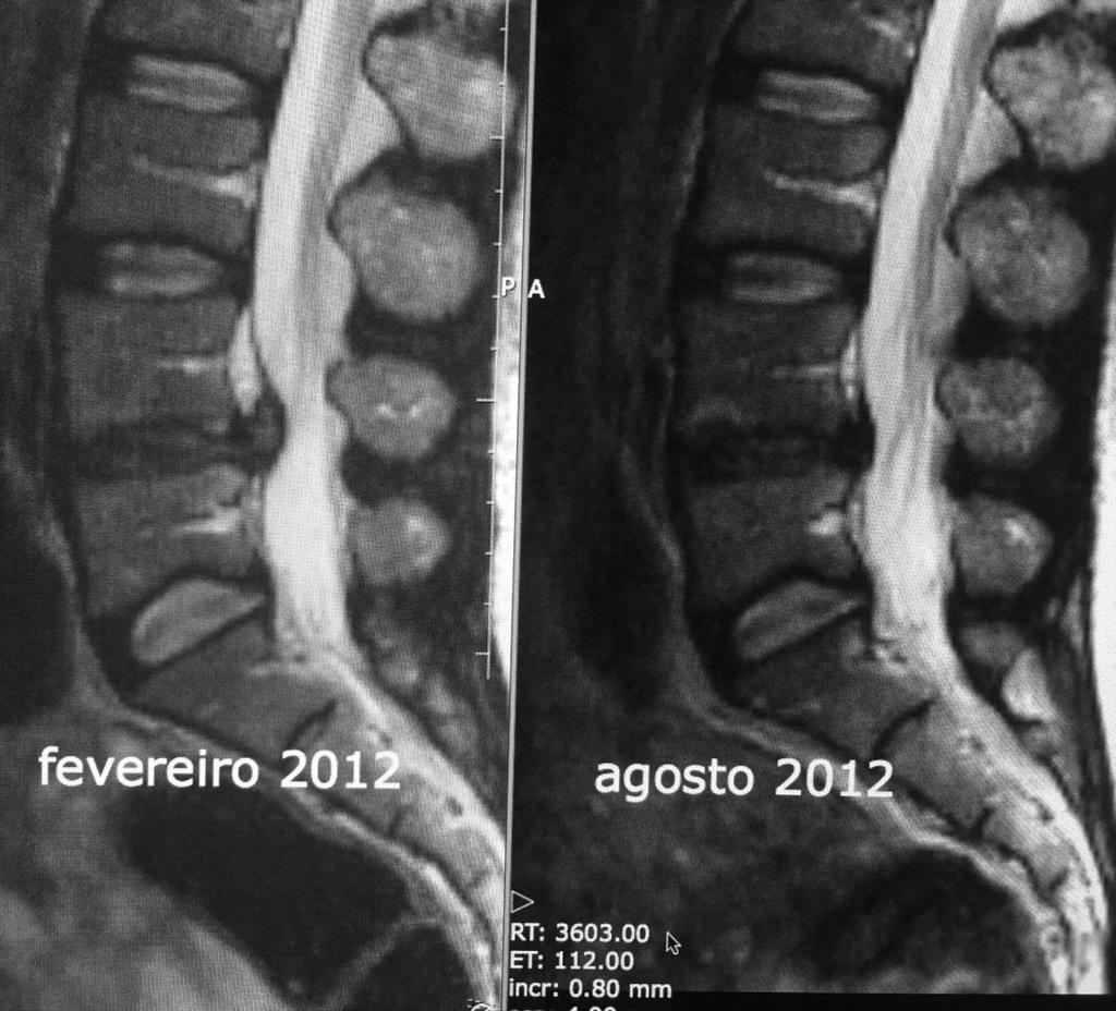 Controle evolutivo Fisioterapia!