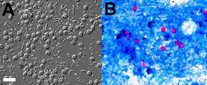 Sistema Digestório Cryptosporidium Cryptosporidium muris glândulas gástricas do abomaso de bezerros,