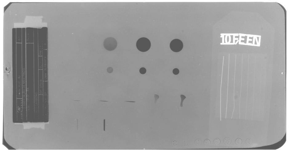 121 Figura 103 - Radiografia computadorizada com raios X na amostra metálica. Figura 104 - Radiografia computadorizada com raios X na amostra metálica, após tratamento digital de imagem.