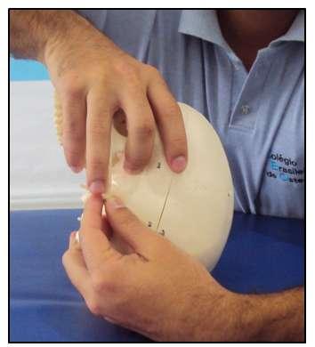 Teste de mobilidade das suturas esfenopetrosa e esfenoescamosa esquerda 1.9.2.