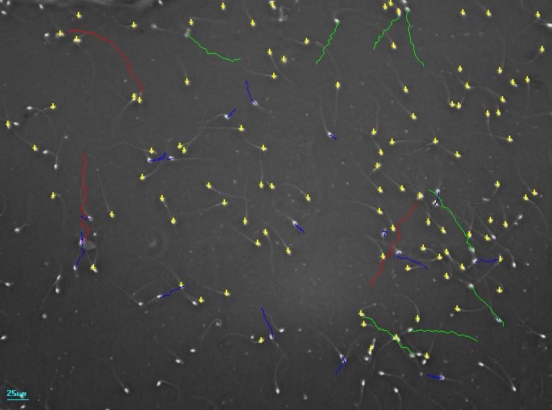 A imagem acima mostra a captura de uma área da amostra, e as linhas coloridas representam a trajetória dos espermatozoides em um determinado tempo.
