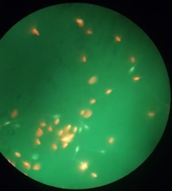 29 Figura 7. Espermatozoides asininos descongelados corados com sondas fluorescentes iodeto de propídeo e diacetato de carboxifluoresceína e avaliados por microscopia de epifluorescência.