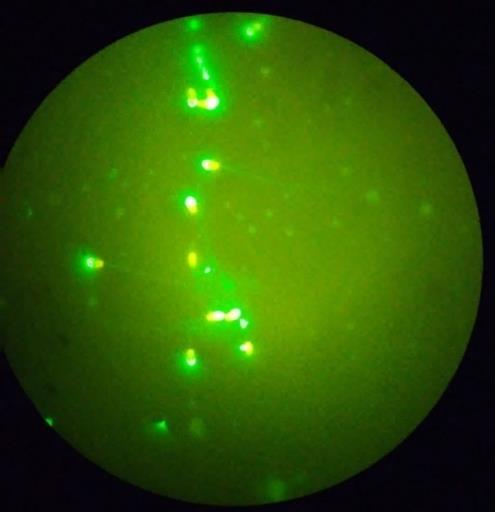 31 Os espermatozoides foram classificados como portadores de acrossomas intactos quando apresentavam a região acrossomal corada com fluorescência verde, ou como acrossomas reagidos, quando