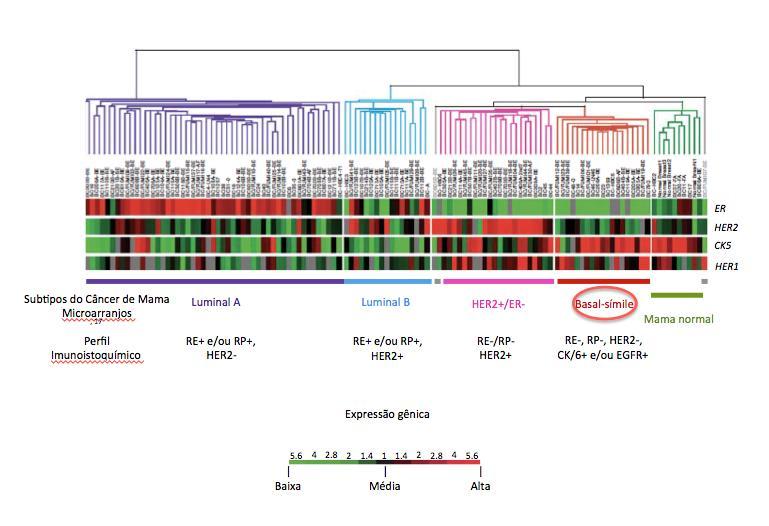 Revisão da Literatura denominados: luminal A, luminal B, basal-símile, HER2+ e mama normal (36). Figura 1. Figura 1: Subtipos moleculares do câncer de mama. Fonte: Perou et al., Jama.