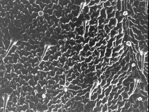 vascular. (Barra = 50 µm).