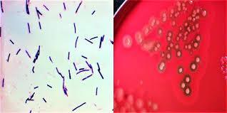 Clostridium perfringens Esporos são raramente observados: in vivo ou após cultivo in vitro (beta-hemolíticos); 5 tipos: A-E (de acordo com a produção de uma ou mais toxinas); Tipo A: TGI de humanos e