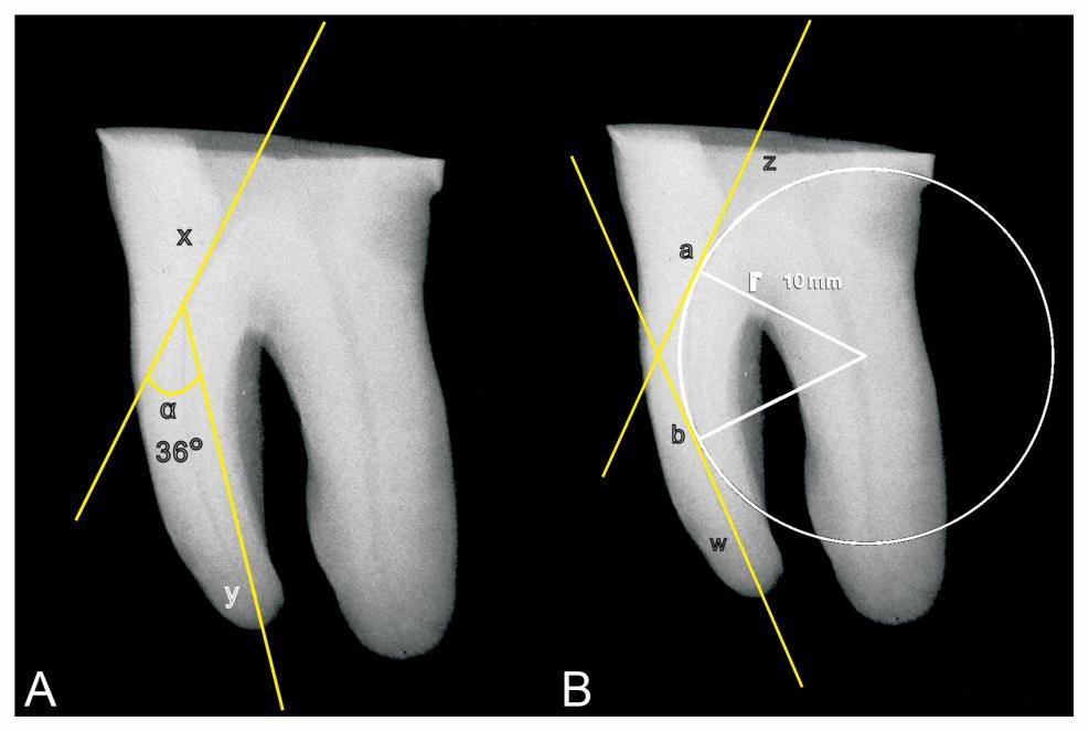 - 48 - Material e Métodos Figura 2 Imagens radiográficas para mensuração do ângulo de curvatura (A) e do raio de curvatura (B).