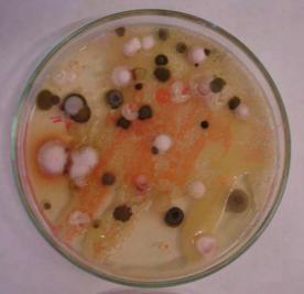 Aspecto das placas do segundo isolamento de microrganismos de cana-de-açúcar, onde podem ser observados os diferentes grupos microbianos, a partir da rizosfera, colmo e folha (valor entre parênteses