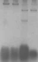 72 1 2 3 4 DNA genômico L-dsRNA M-dsRNA Figura 23. Gel de agarose (1,3%) dos produtos da extração dos plasmídios dsrna. Legenda: 1- T. globosa (1S112); 2 Kluyveromyces marxianus (CCA 510); 3 S.