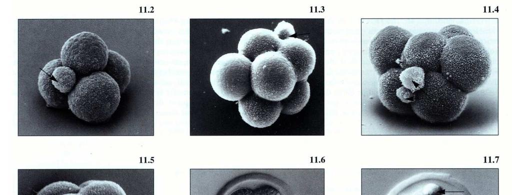 O blastocisto de mamífero contêm MASSA CELULAR INTERNA que formará o embrião propriamente dito