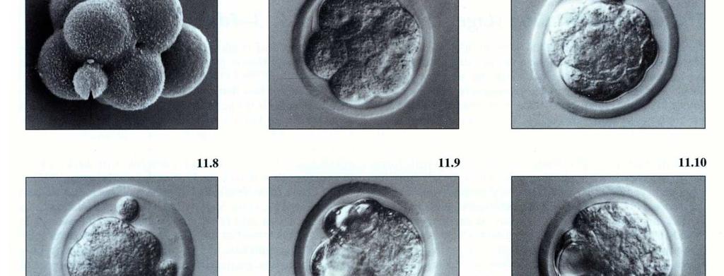 o TROFOECTODE RMA, que formará o córion da placenta Anexos embrionários Interface materno-fetal ausentes