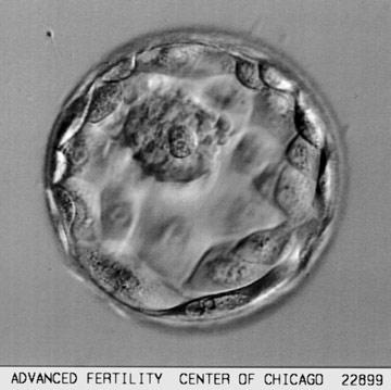 Embrionária da Placenta Porção Embrionária da Placenta Aspectos Morfológicos Planos de clivagem Vitelo