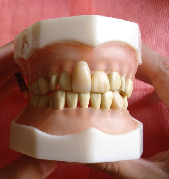 Laura Pintado INTRODUÇÃO Este é um guia rápido, passo a passo, das atividades laboratoriais de execução de provisórios em dentes anteriores que receberam preparo protético total.