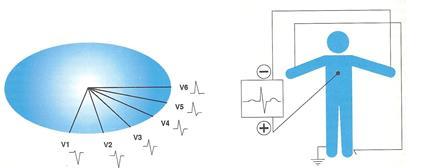 DERIVAÇÕES PRÉ-CORDIAIS V1 Por ser uma derivação pré-cordial, o eletrodo é posicionado no 4º espaço intercostal à direita, próxima ao rebordo external (paraexternal).